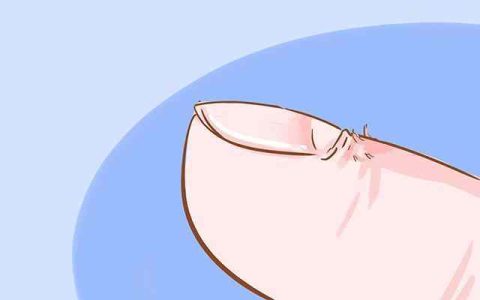 手上长倒刺是缺维生素？两码事儿！