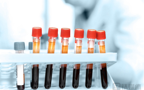 济南高新欲转型医疗：定增近4亿元“输血”现金流，矿业依旧是业绩主力