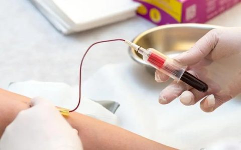 孕期常见抽血检查你了解吗？