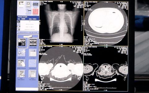 如果X光机会思考