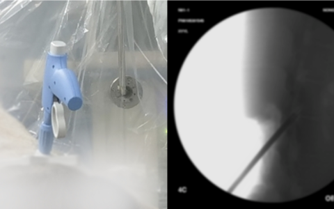 新云医疗完成数千万元B轮融资，推动多款国内首创疼痛器械进临床