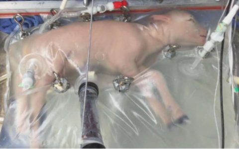 机器替人生娃成真？全球首例人造子宫人类临床试验将启动