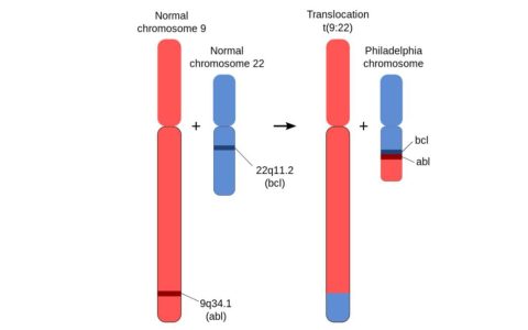 我们是如何战胜慢粒白血病的？